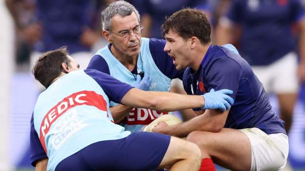 Copa Mundial de Rugby 2023: el capitán de Francia, Antoine Dupont, operado de una fractura de pómulo