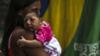 Мать держит на руках дочь, рожденную с микроцефалией от вируса Зика