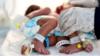 Медсестра обслуживает новорожденных сиамских близнецов в инкубаторе отделения интенсивной терапии ребенка больницы аль-Сабин в Сане, Йемен. Фото: 18 декабря 2020 г.