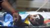 Индийская женщина держит за руку своего ребенка в отделении энцефалита больницы Баба Рагхав Дас в Горакхпуре, в северном индийском штате Уттар-Прадеш, 14 августа 2017 г.