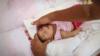 Элис Витория Гомес Безерра, трехмесячная больная микроцефалией, помещена в кроватку своим отцом Жоао Батиста Безерра в Ресифи, Бразилия, 27 января