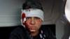 Раненый сирийский мальчик сидит в автомобиле после того, как, как сообщается, правительство нанесло удар с воздуха в Маарат Мисрин на северо-западе Сирии, 25 февраля 2020 года