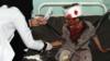 Фотография из архива, на которой изображен йеменский мальчик, находящийся на лечении в больнице после авиаудара коалиции под руководством Саудовской Аравии по автобусу с детьми в контролируемой повстанцами провинции Саада 9 августа 2018 г.