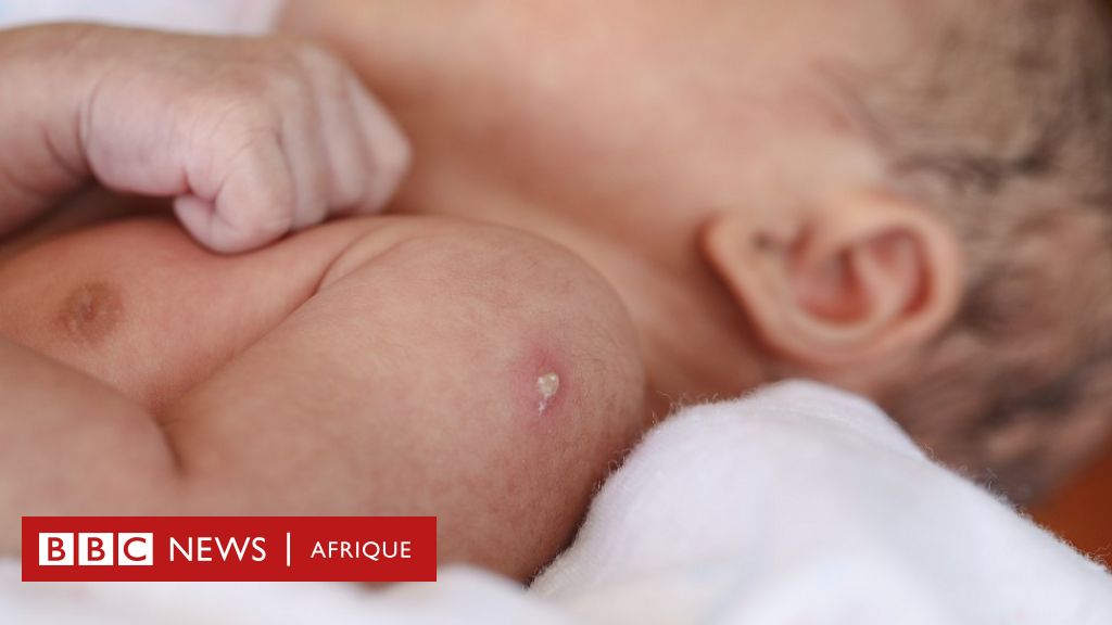 Bain bébé fièvre, après le vaccin, après le biberon : bonne ou mauvaise  idée ? 