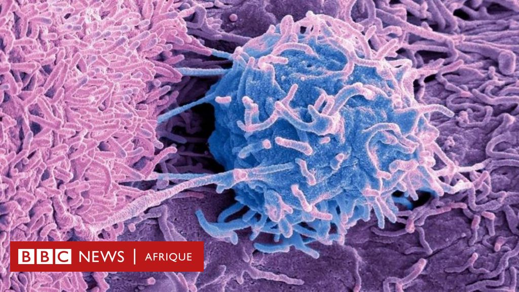 Cancer : Le mystère des microbes vivant à l'intérieur des tumeurs ...
