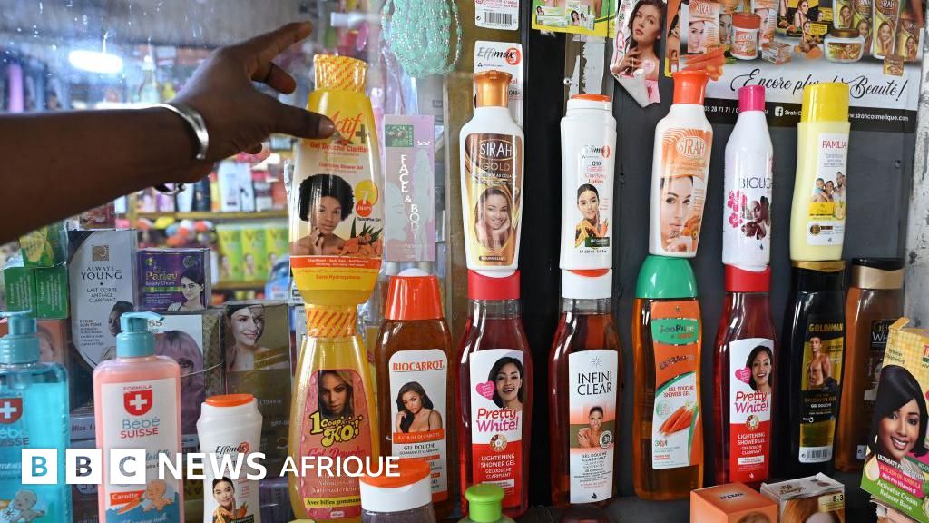 Dépigmentation : Pourquoi tant de femmes africaines ont recours au blanchiment de la peau ?