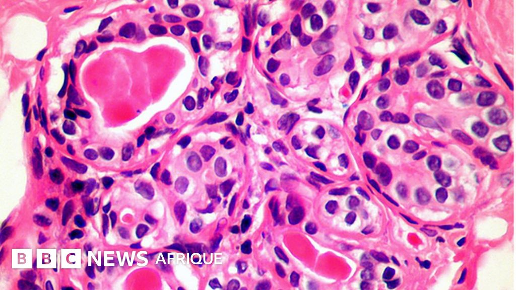 Une nouvelle découverte dans le système immunitaire