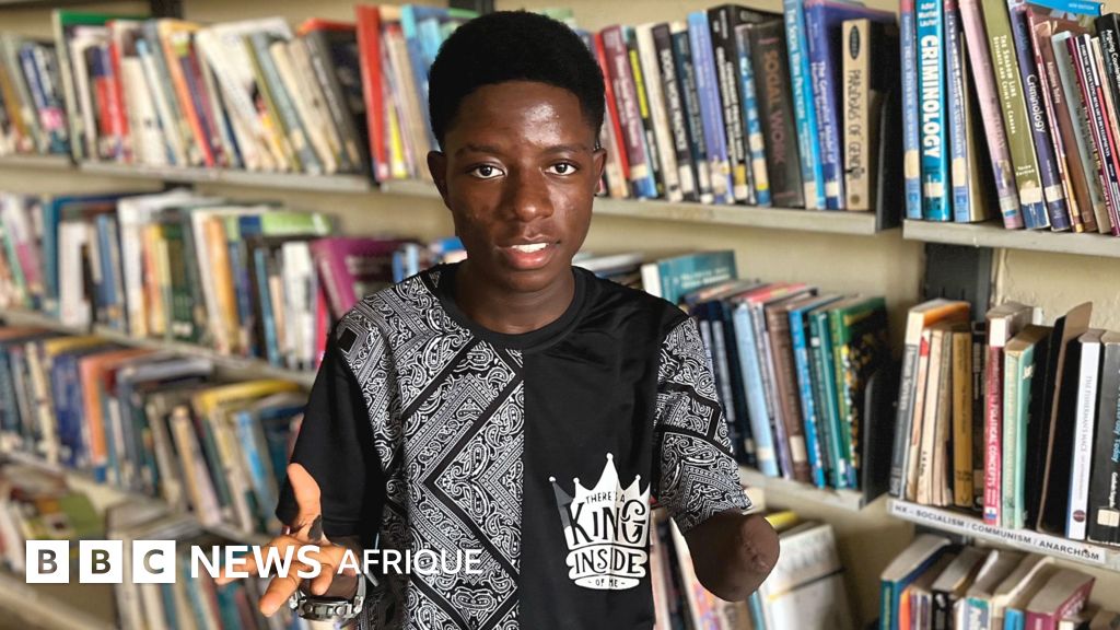Au Nigéria,Torturé et amputé, un étudiant lutte pour accéder à l’éducation