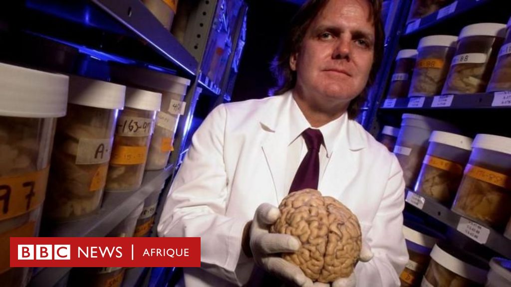 Cerveau : Les secrets révélés par l’une des études les plus uniques et ambitieuses jamais réalisées