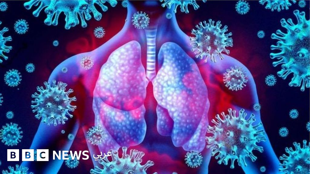 فيروس كورونا: اختبار عقار الإيبوبروفين كعلاج للوباء
