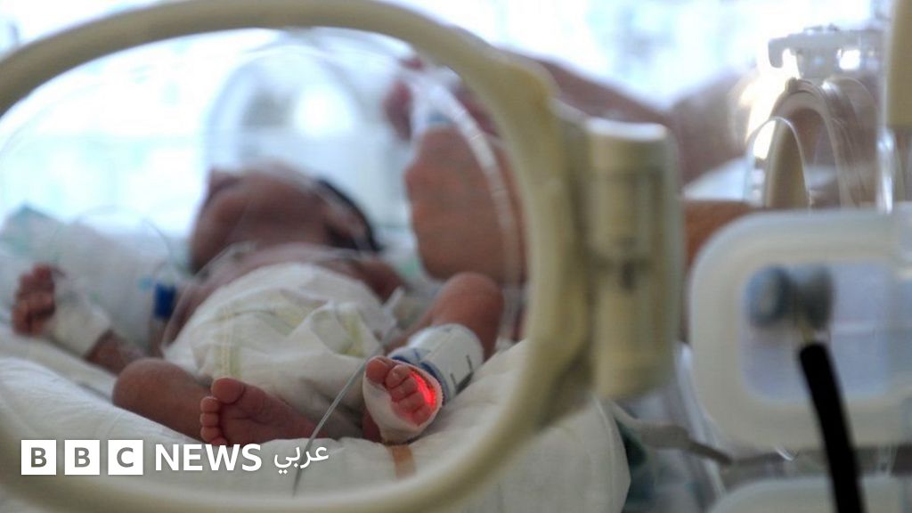 رضيع يخرج للحياة من رحم أمه المتوفاة دماغيا منذ 3 أشهر في البرتغال Bbc News عربي