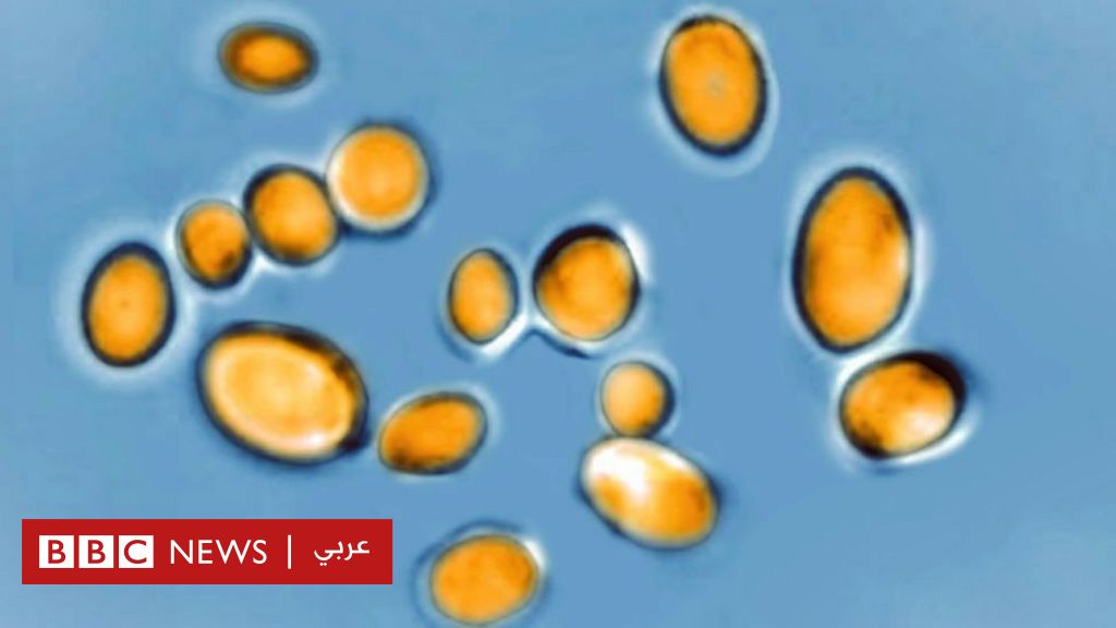 How is the drug-resistant fungus, Candida auris, spreading across hospitals in America?