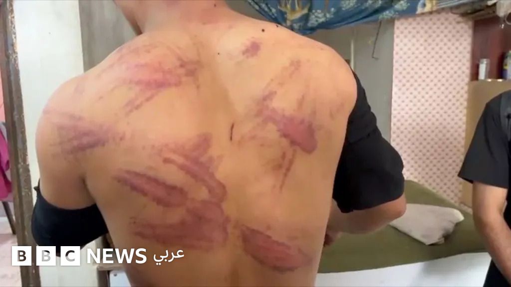 إيران وأفغانستان: طهران تعيد 1.5 مليون أفغاني إلى بلادهم، وتتهم بعضهم بـ ”التجسس لصالح إسرائيل” - BBC News عربي