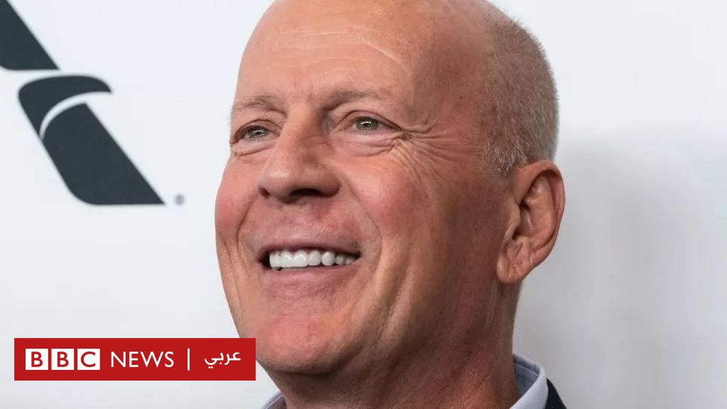 Bruce Willis: The American star’s family says he has frontotemporal dementia