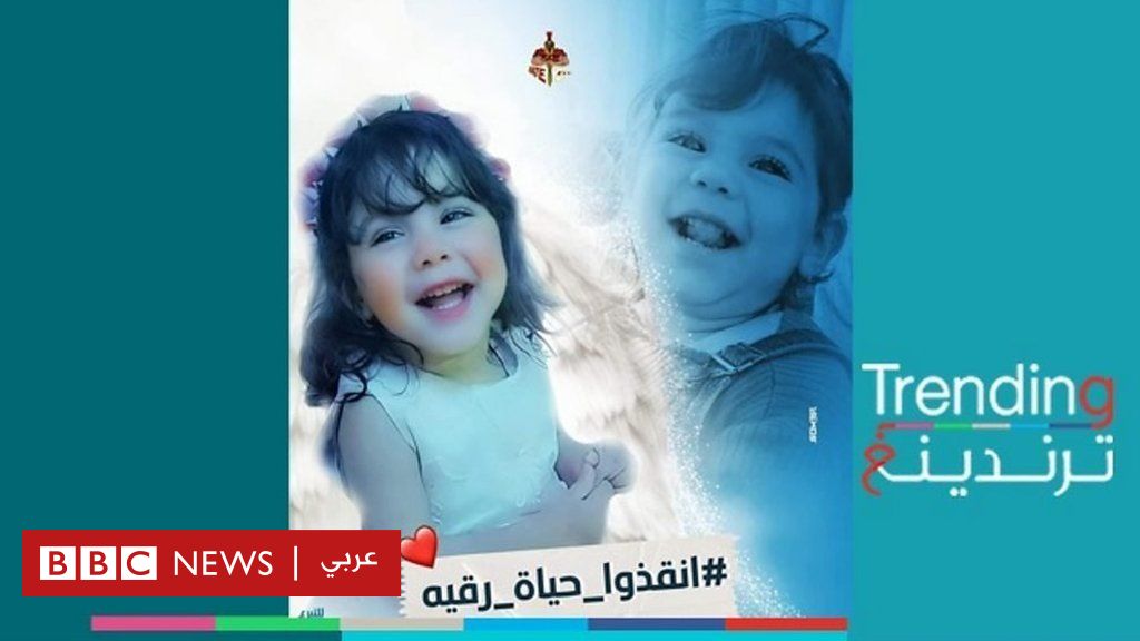 الطفلة رقية: حملة لجمع 2 مليون دولار لعلاج طفلة مصرية