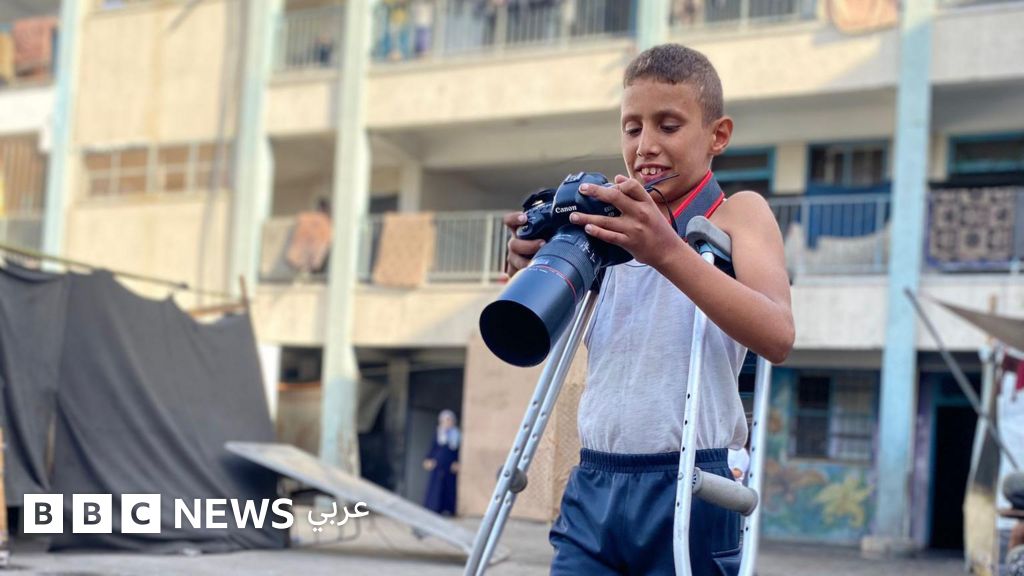 "من أنبوب بلاستيكي إلى ساق بديلة"، قصة طفل غزي فقد ساقه في غارة إسرائيلية