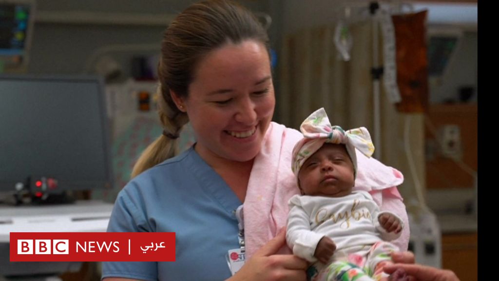 أصغر رضيعة في العالم  ولدت بحجم التفاحة وتحدت توقعات الأطباء - BBC News Arabic