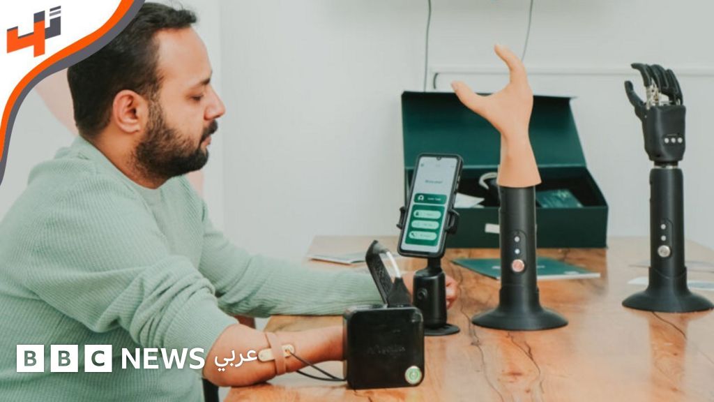 أطراف اصطناعية ذكية باستخدام التكنولوجيا المتقدمة