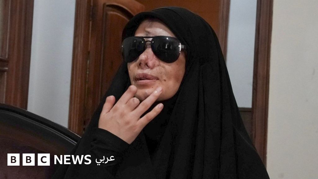 "فقدت عينيّ"- ضحايا تفجيرات البيجر يتذكرون الرسالة التي أفقدت العشرات في لبنان بصرهم