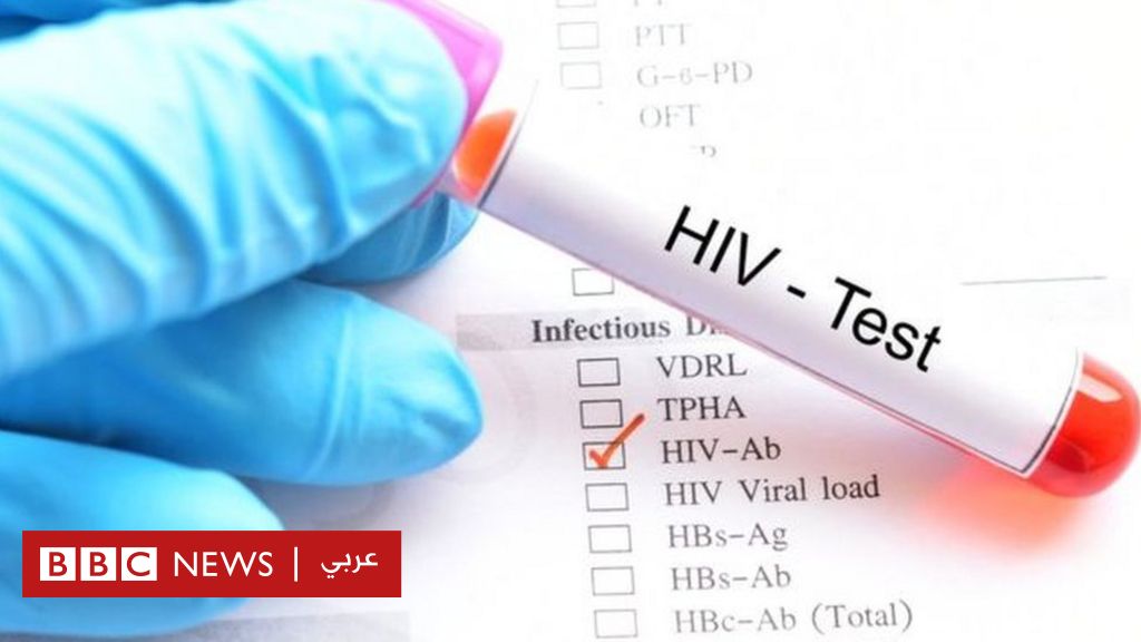 Hiv من الامراض المعدية التي يسببها فيروسات