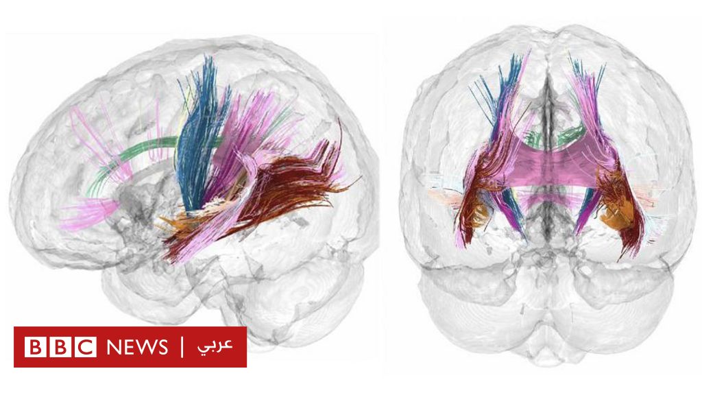 أشعة تفصيلية تكشف كيف يتغير دماغ المرأة أثناء الحمل 