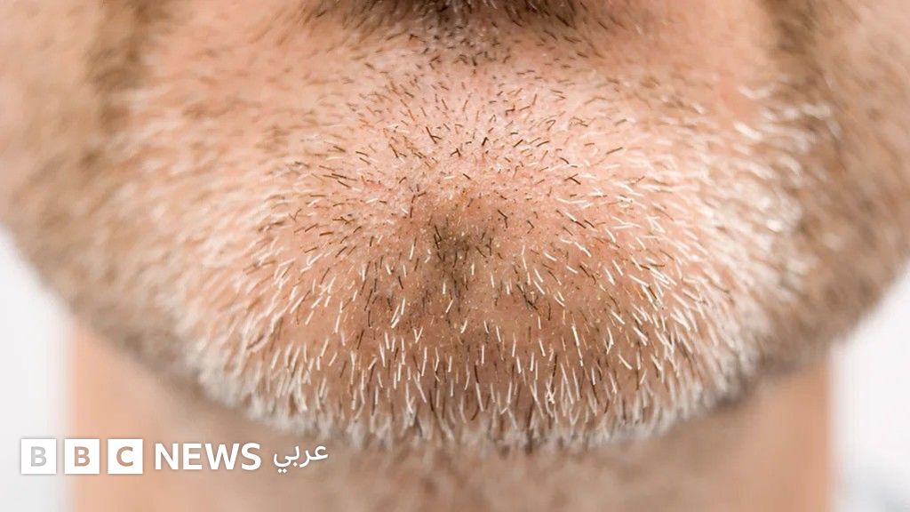 لماذا الإنسان هو الكائن الوحيد الذي يمتلك ذقناً؟