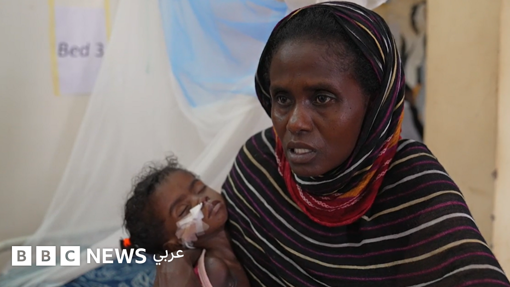 لم تستطع أن تنقذهما معاً.. أمٌّ سودانية تضطر للاختيار بين علاج طفلتيها التوأم