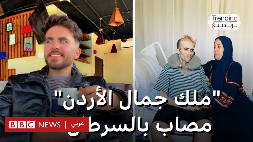 أيمن علي.. ”ملك جمال الأردن” يشارك رحلة علاجه من مرض السرطان - BBC News عربي