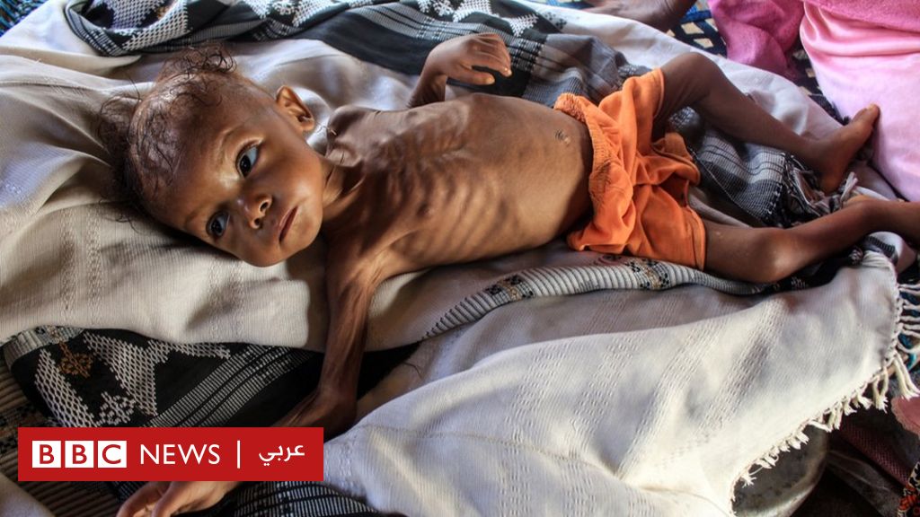 هل تزيد تداعيات حرب أوكرانيا من احتمالات المجاعة في اليمن؟
