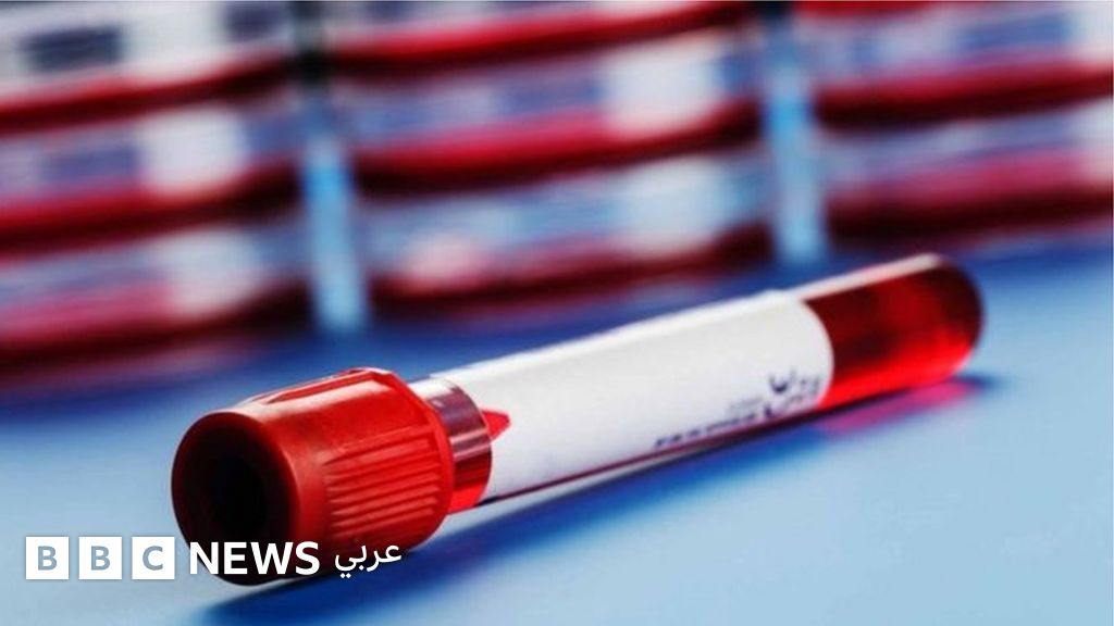 فيروس كورونا: حل لغز جهاز المناعة يبعث الأمل في التوصل لعلاج فيروس كورونا: حل لغز جهاز المناعة يبعث الأمل في التوصل لعلاج