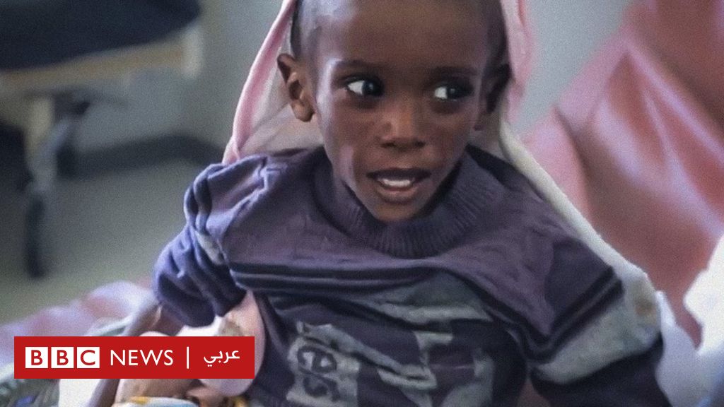 Crisis in Tigray: no medicines in hospitals and malnutrition threatens the lives of children