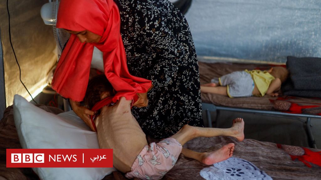 المكتب الحكومي في غزة يحذر من ارتفاع الوفايات بسبب المجاعة، وتسجيل حالات "تسمم" شمالي غزة