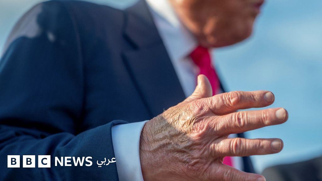 ترامب: ما هي الحالة الصحية للرئيس الأمريكي بعد ظهور تورم في ساقيه وكدمات في يديه؟ - BBC News عربي