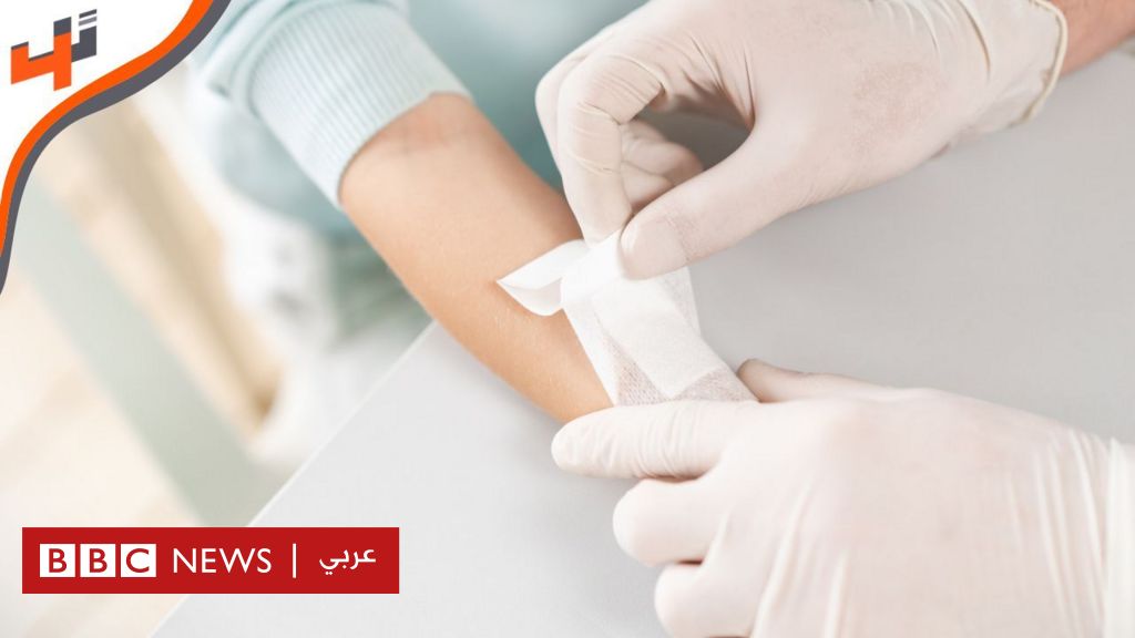 تقنية جديدة لالتمام الجروح بسرعة