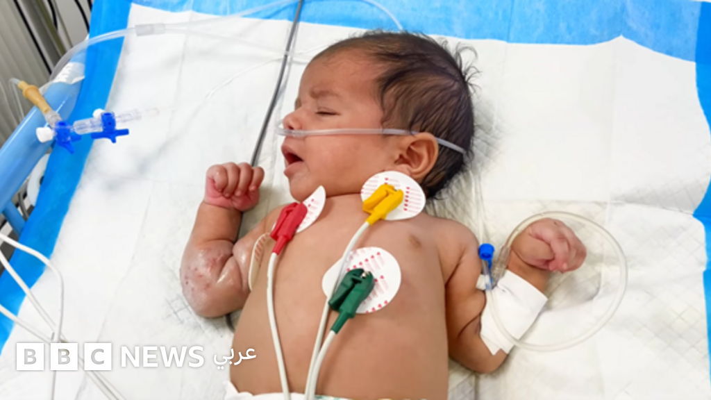 مصابون بالعناية المركزة، ومنظمة الصحة العالمية ترجّح وجود كوفيد-19 وفيروسات أخرى بقطاع غزة، فما مدى الخطورة؟