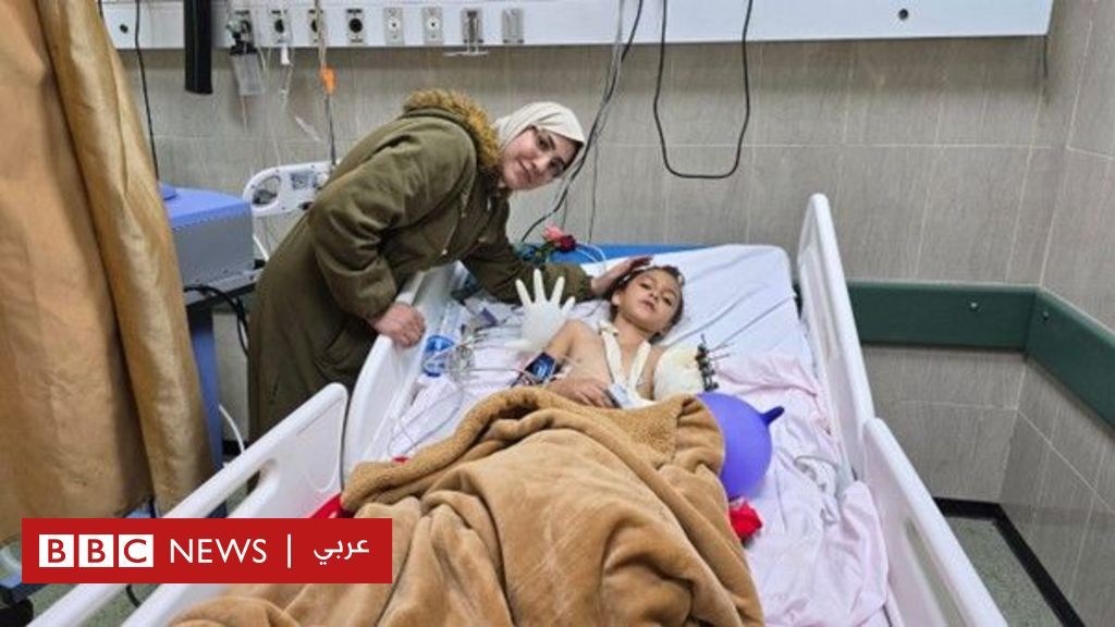 حرب غزة: جراح عراقي يعيد وصل يد طفلة غزاوية بعد بترها وفقدانها تحت الركام - BBC News عربي