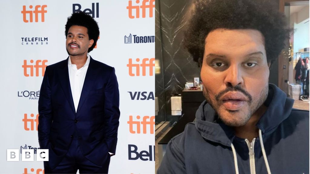 The Weeknd Check out the singer's major transformation BBC Newsround