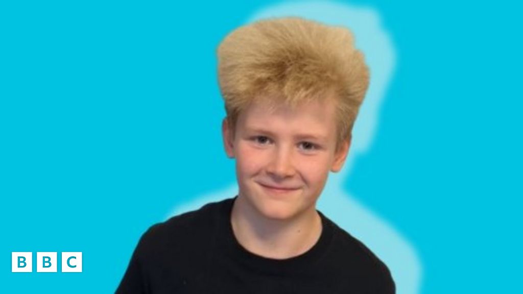 Hair Syndrome 10yearold Sam has rare condition BBC