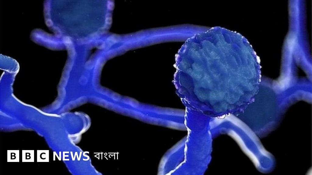 Bir yigit yosh xolasini sikdi Omma oldida yalangoch