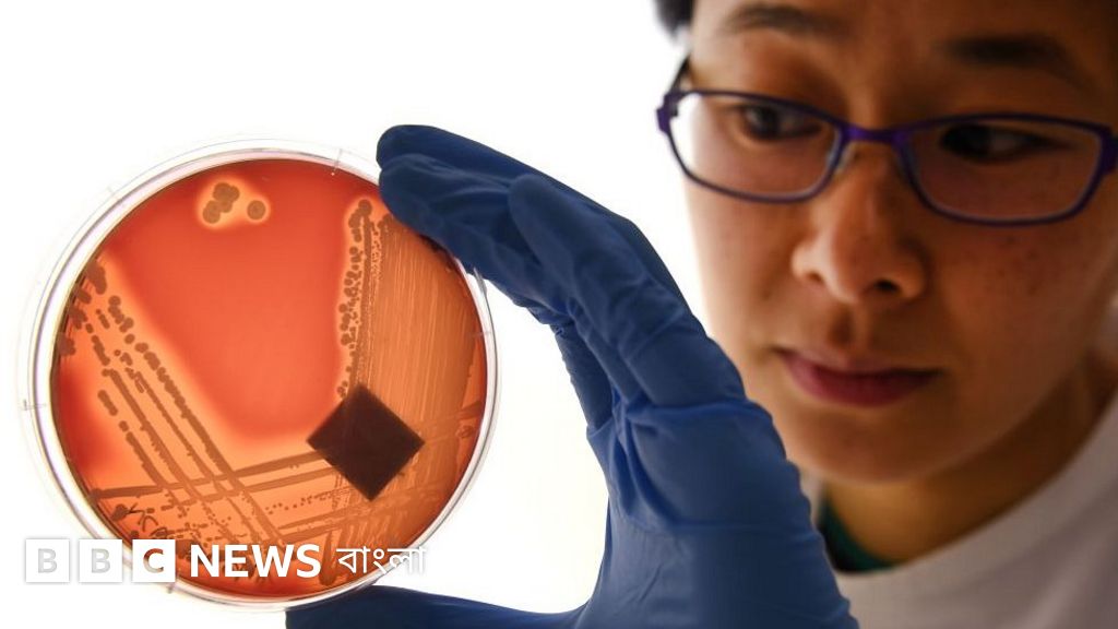 Jinsiy aloqa paytida vaginal qon ketish Mozhgadagi jinsiy aloqa