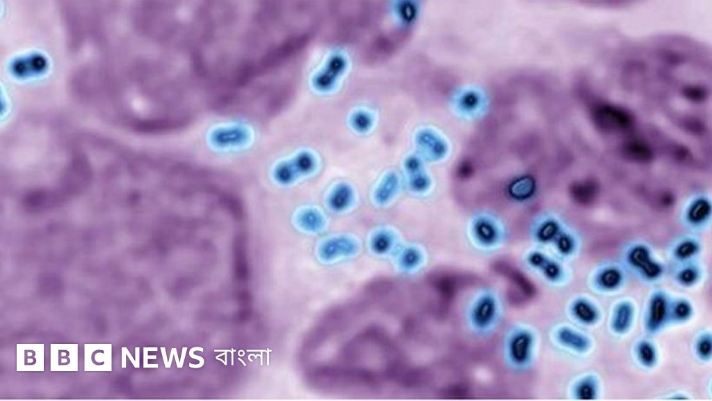 Pornografik yigit pulda emas, jinsiy aloqada ijara oladi.