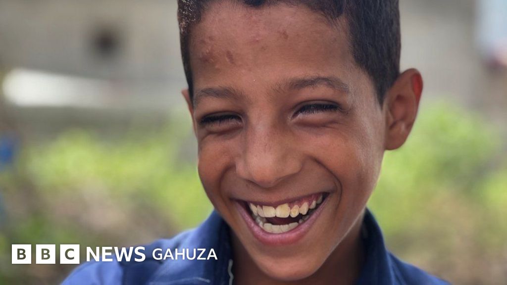 Yemen Uko umwana agendana ubumuga bwo kutabona yafashije ishule