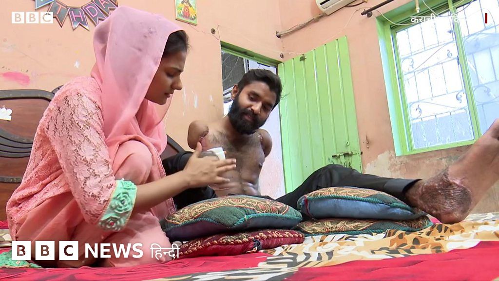 पाकिस्तान की लव स्टोरी: दाऊद सिद्दीक़ी को कृत्रिम हाथ मिल सकते हैं?