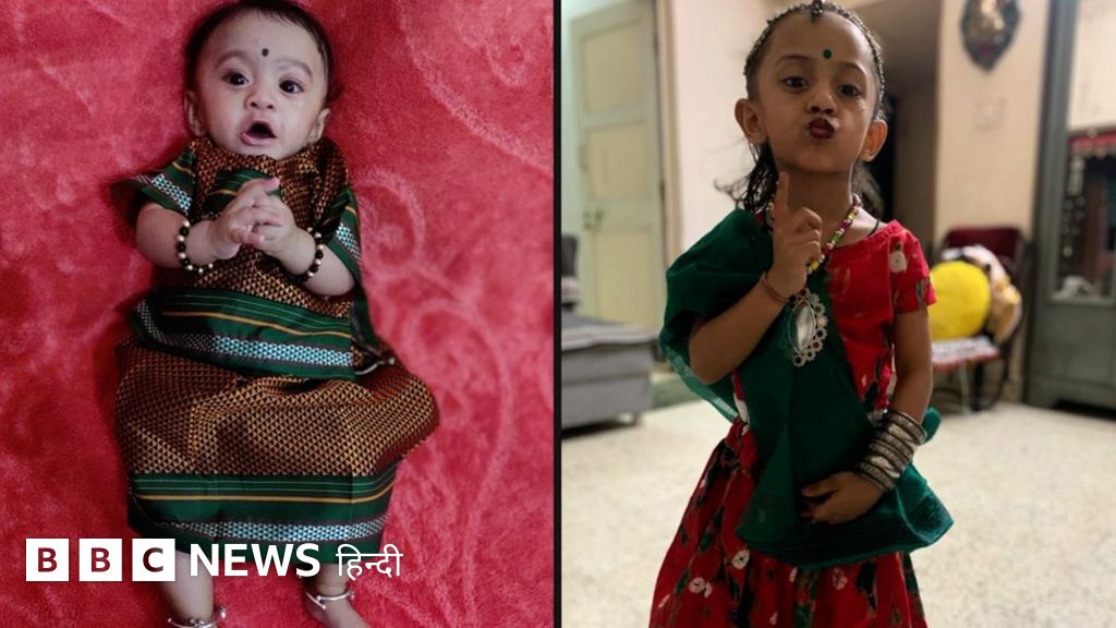 24 हफ़्ते से पहले जन्मीं, 500 ग्राम से कम वज़न, शिवान्या और जियाना की कहानी