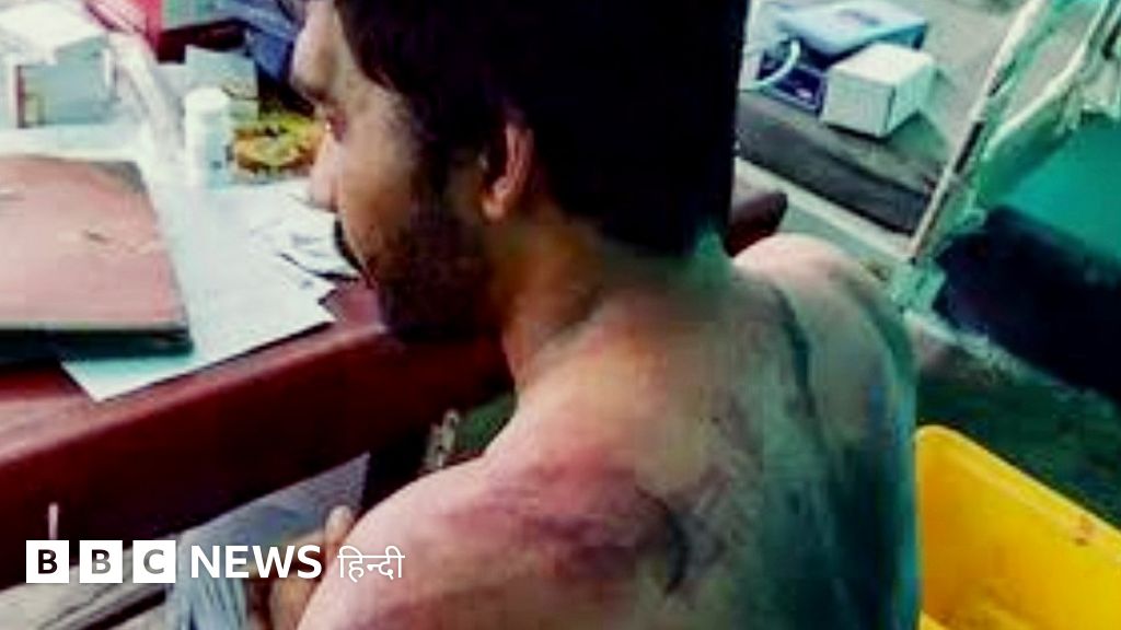 पीएम मोदी को डॉक्टरों पर गर्व है लेकिन उन पर होने वाले हमले कैसे रुकेंगे?