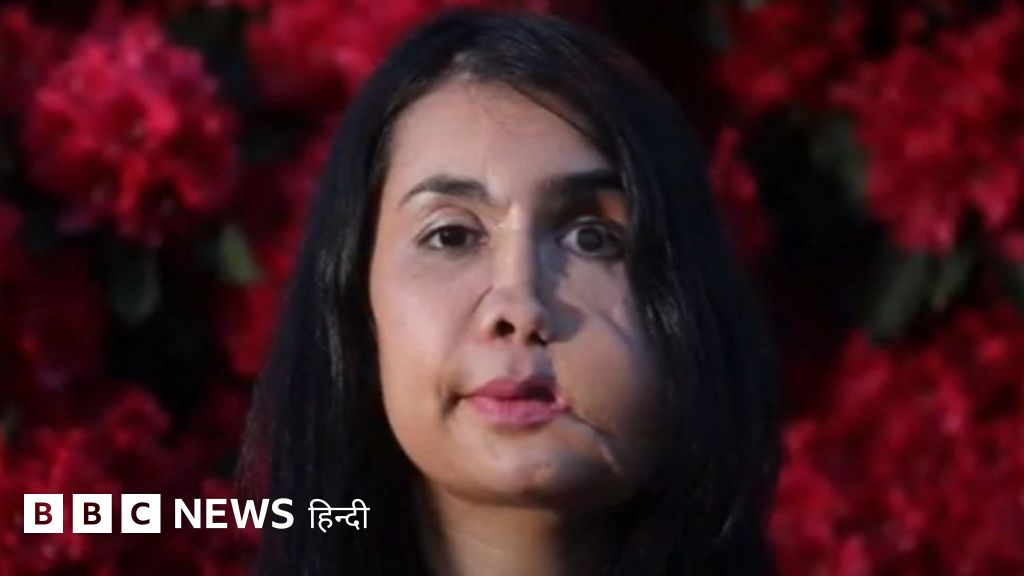 एक गोली, 22 ऑपरेशन झेलने वालीं शकीला