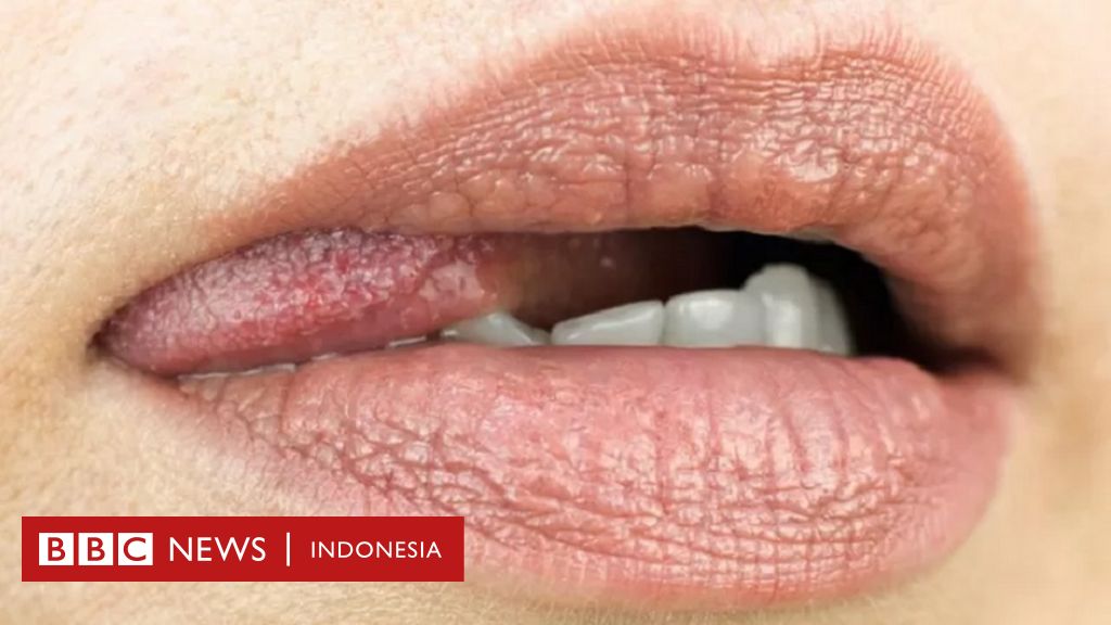 Ngocok Memek Pake Terong Lalu Dimasukin Ke Mulut - Seks oral tanpa kondom dapat menularkan penyakit, bagaimana cara melindungi  diri? - BBC News Indonesia