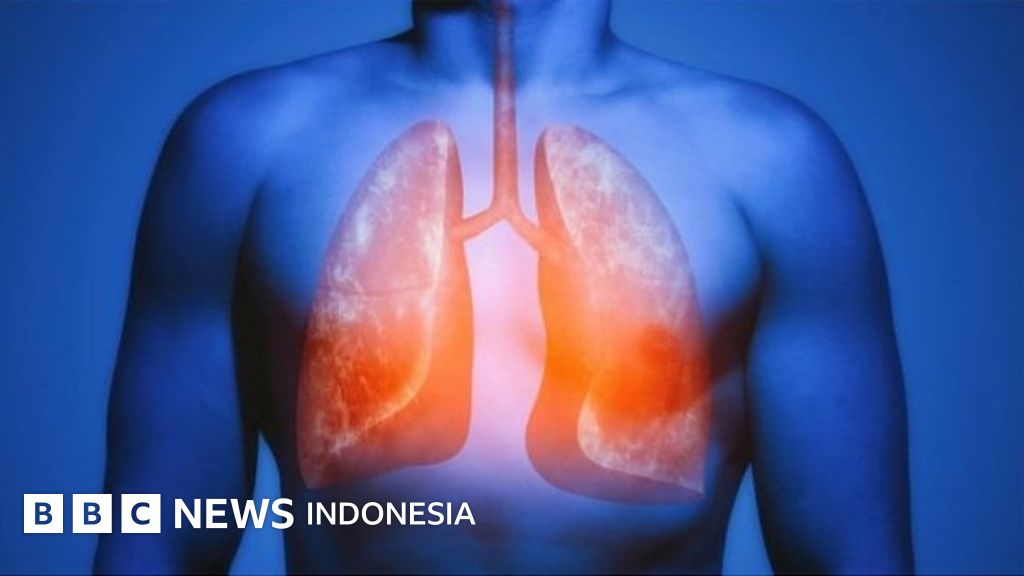 Paru-paru 'secara ajaib' menyembuhkan kerusakan akibat merokok - BBC