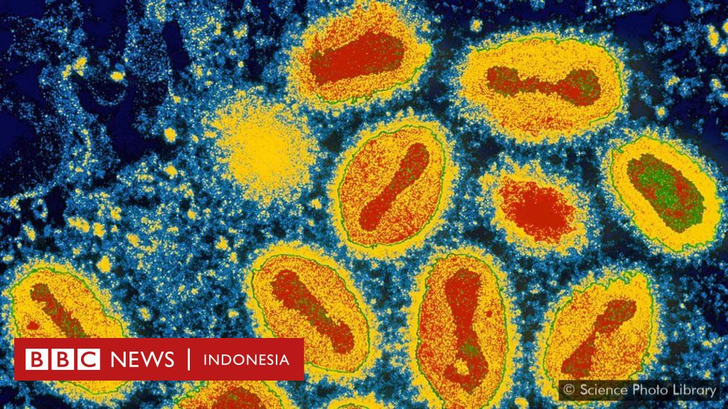 Virus-virus mematikan yang muncul lalu menghilang tanpa jejak - BBC