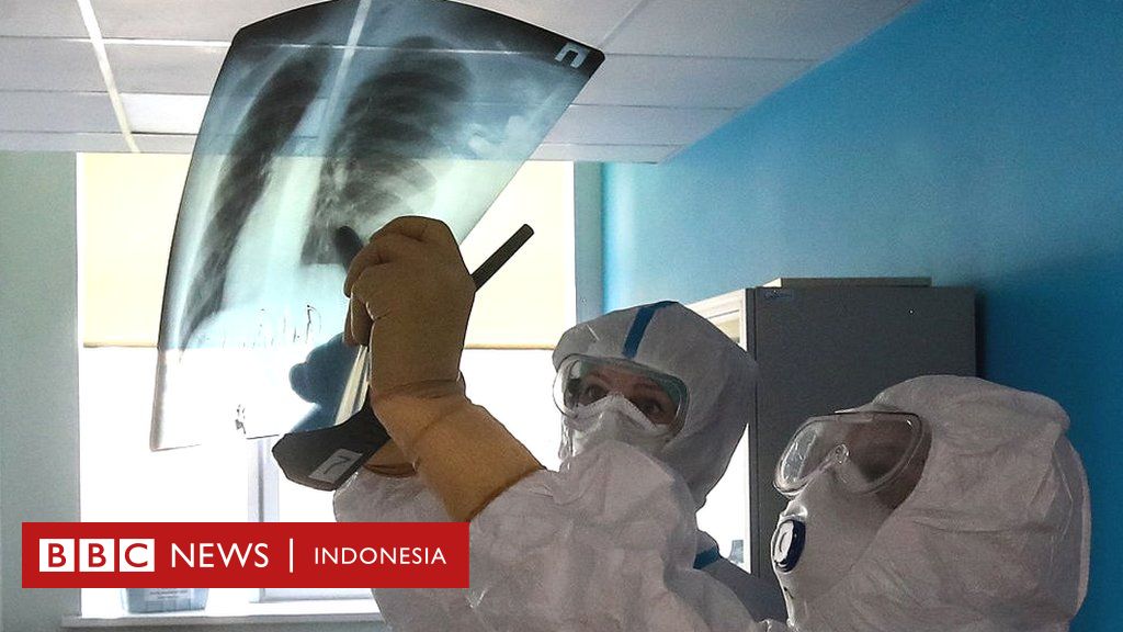 Virus Corona Terobosan Baru Memeriksa Paru Paru Pasien Covid Dengan